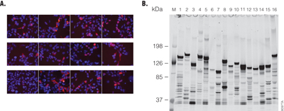 Two-panel figure showing expression of N-terminal HaloTag® fusion proteins in HEK293 cells, with fluorescent imaging of labeled proteins in living cells and gel-based detection of the same proteins after cell lysis.